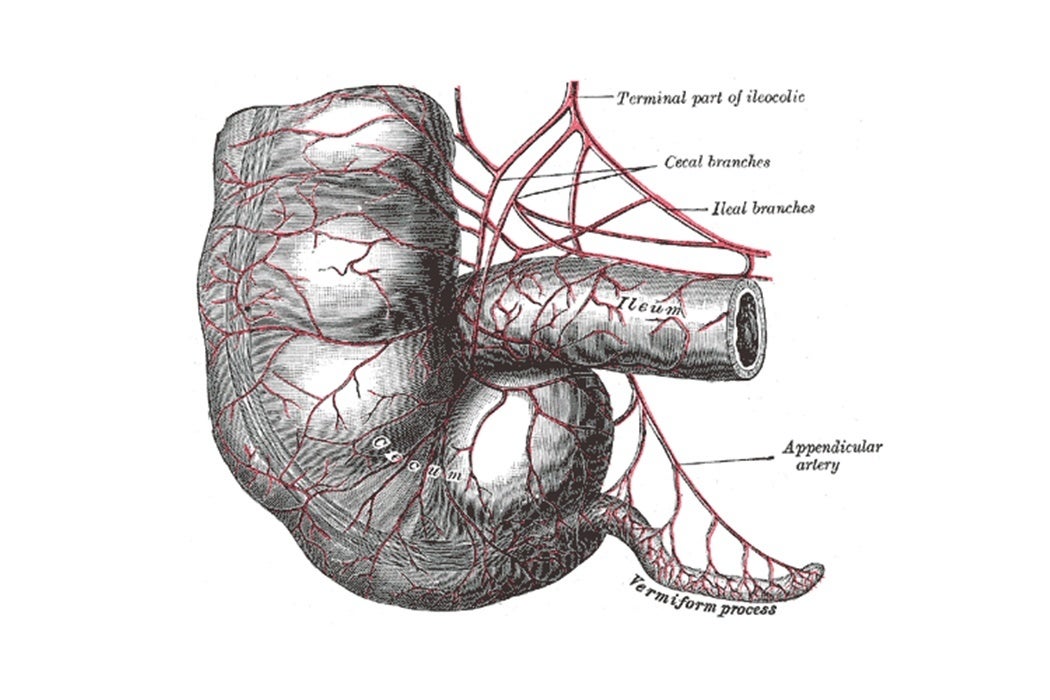 Drawing of the appendix, labeled as vermiform process at lower right.