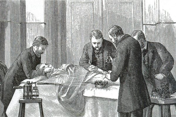 Lister spraying phenol over the wound while the doctors perform an operation.